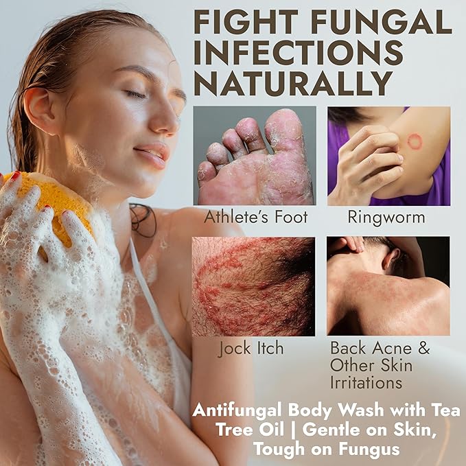 Antifungal Body Wash with Tea Tree Oil | Antibacterial Soap for Back Acne,Treats Ringworm, Eczema & Jock Itch | Antibacterial Body Soap For Men And Women | Includes Silicon Scrubber (16.9 oz)