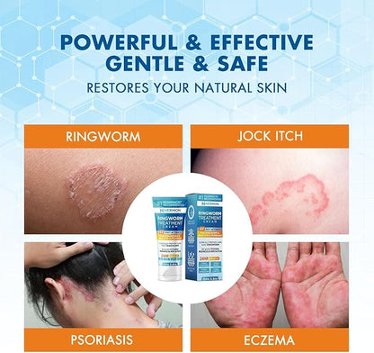 Hermon Powerful Antifungal Ringworm Cream - Effective Treatment for Stubborn Ringworm, Jock Itch, Eczema, Tinea Versicolor, Athlete's Foot - for Adults and Kids - 100ml (2 Pack)