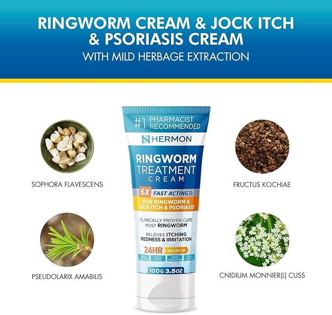 Hermon Powerful Antifungal Ringworm Cream - Effective Treatment for Stubborn Ringworm, Jock Itch, Eczema, Tinea Versicolor, Athlete's Foot - for Adults and Kids - 100ml (2 Pack)
