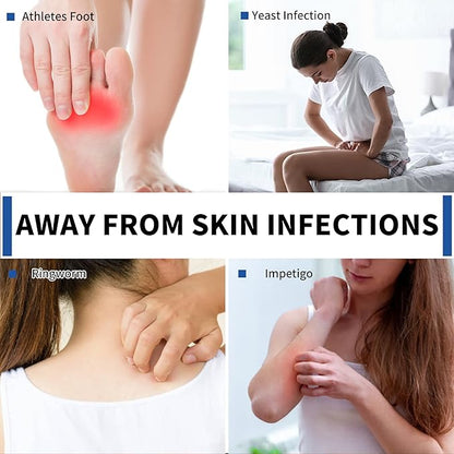Antifungal Medicated Soap Bar, Tea Tree Oil Body Soap Bar, Athletes Foot Jock Itch Ringworm Yeast Infection Treatment With Natural Oil
