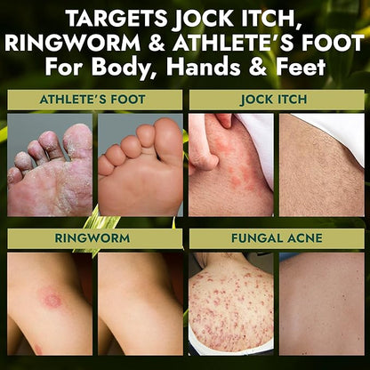 Antifungal Soap Pack of 2 | Medicated Jock Itch Treatment, Fights Ringworm & Athlete's Foot | Antibacterial Soap Includes Scrubber for Deeper Cleansing & Exfoliation | Tea Tree Oil 1% Tolnaftate