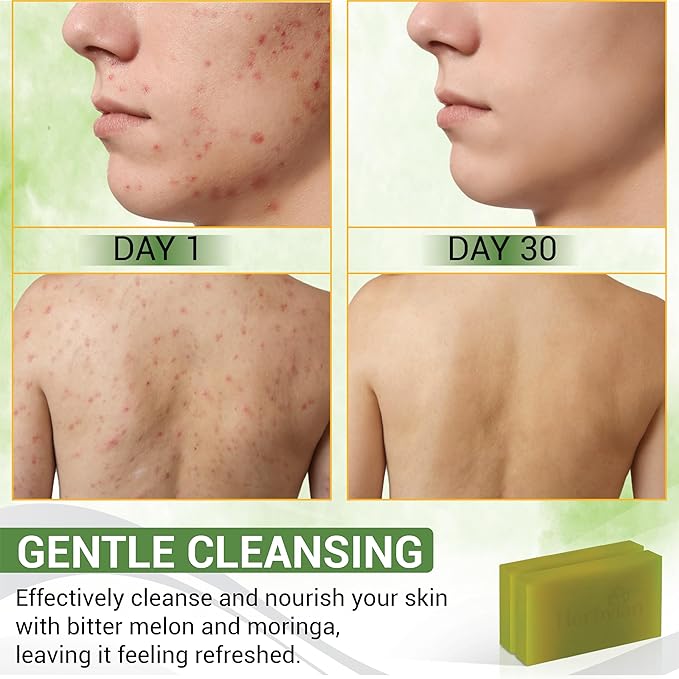 2 PCS Bitter Melon Moringa with Natural Tea Tree Oil Soap Bar for Back Acne, Anti Bacterial Momordica Charantia Body Soap, Anti-Acne, Herbal Cleansing with Melaleuca Quinquenervia Oil