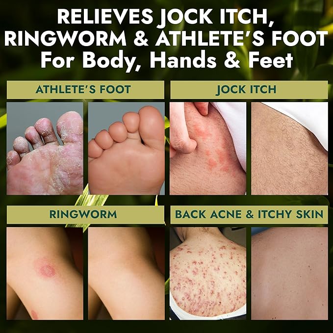 Antifungal Soap | Deep-Cleansing & Exfoliating Bar for Men & Women | Natural Ingredients with Tea Tree & Eucalyptus | Helps Soothe Jock Itch, Ringworm & Athlete’s Foot Pumice Bar Soap