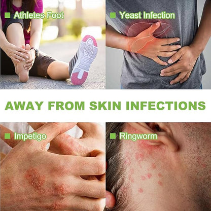 Antifungal Medicated Soap Bar, Athletes Foot Jock Itch Ringworm Yeast Infection Treatment for men, Tea Tree Oil Body Soap Bar With Natural Tea Tree Oil, Eucalyptus Oil and Lavender Oil, 2PCS