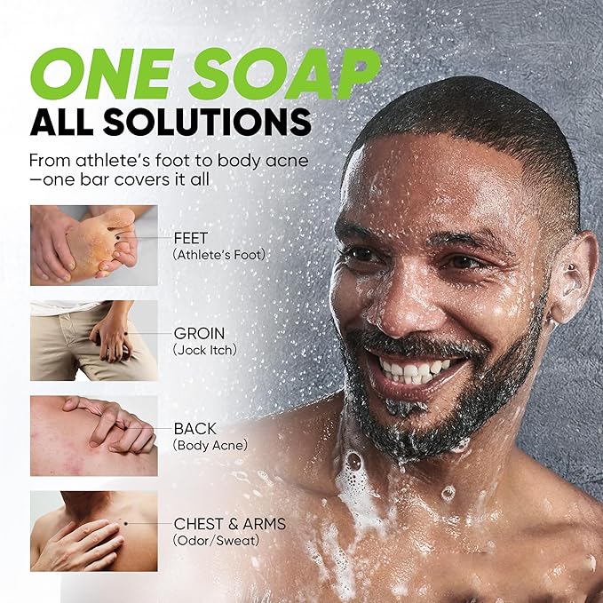 Roycederm Antifungal Soap Bar - Helps with Athlete’s Foot, Jock Itch, Ringworm for Active Skin - Relieves Itching Burning Scaling and Discomfort with Tea Tree Oil, Charcoal & Volcanic Ash