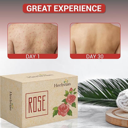 2 Pcs Rose Herbal Soap Bars with Cymbopogon Martinii Scent and Lonicera Japonica, Moisturizing Soap Bars, Bath Body and Face Soap, Rosa Cleanser Soap Bar, Soap for Men, Women, Teen and All Skin Types
