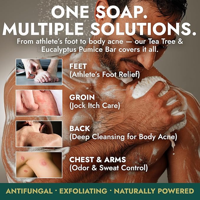 Antifungal Soap | Deep-Cleansing & Exfoliating Bar for Men & Women | Natural Ingredients with Tea Tree & Eucalyptus | Helps Soothe Jock Itch, Ringworm & Athlete’s Foot Pumice Bar Soap